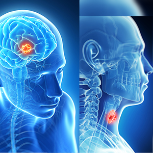 Head & Neck Cancers